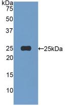 DAB staining on IHC-P; Samples: Human Kidney Tissue; Primary Ab: 20μg/ml Rabbit Anti-Human AFM Antibody Second Ab: 2µg/mL HRP-Linked Caprine Anti-Rabbit IgG Polyclonal Antibody