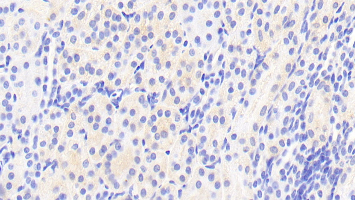 DAB staining on IHC-P. Samples: Human Tissue)