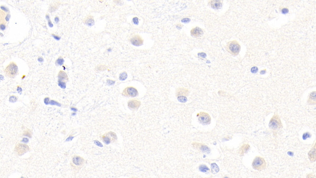 Afamin (AFM) Polyclonal Antibody - image 5