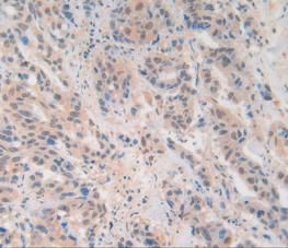 Adhesion Regulating Molecule 1 (ADRM1) Polyclonal Antibody - image 5