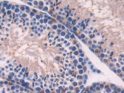 DAB staining on IHC-P; Samples: Mouse Heart Tissue.