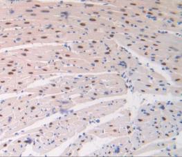 Adenosine Kinase (ADK) Polyclonal Antibody - image 5