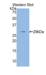 Western Blot; Sample: Human Liver lysate; ; Primary Ab: 3µg/ml Rabbit Anti-Human ADK Antibody; Second Ab: 0.2µg/mL HRP-Linked Caprine Anti-Rabbit IgG Polyclonal Antibody;