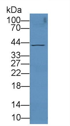 DAB staining on IHC-P; Samples: Human Liver Tissue; Primary Ab: 20µg/ml Rabbit Anti-Human ADK Antibody Second Ab: 2µg/mL HRP-Linked Caprine Anti-Rabbit IgG Polyclonal Antibody