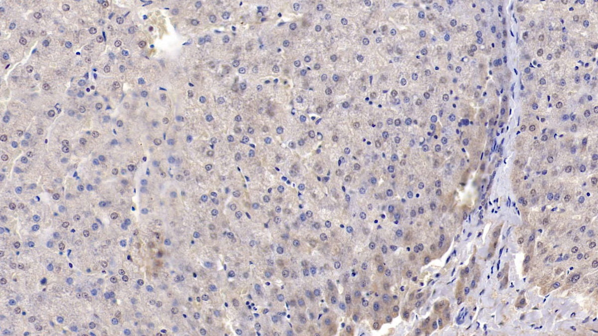 DABstainingonIHC-P.Samples:HumanTissue)
