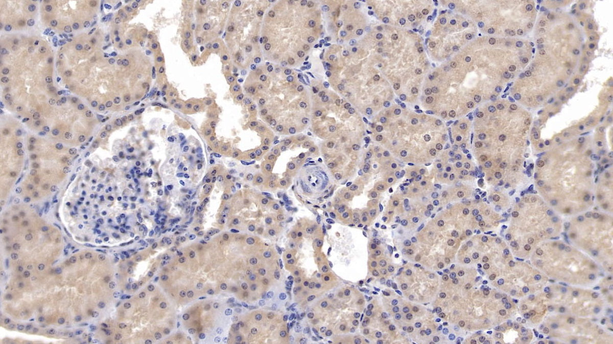 Adenosine Kinase (ADK) Polyclonal Antibody - image 5