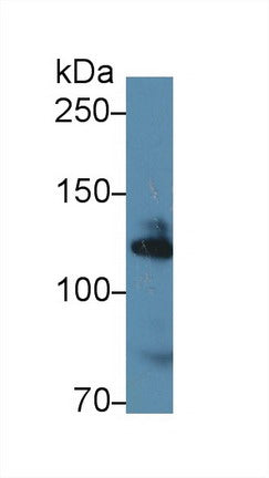 Western Blot; Sample: Recombinant protein.