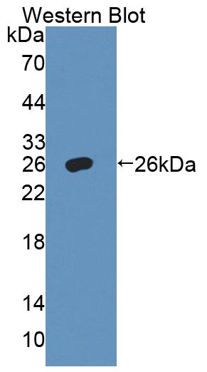 DAB staining on IHC-P; Samples: Mouse Kidney Tissue;  Primary Ab: 20µg/ml Rabbit Anti-Mouse ADD1 Ant
