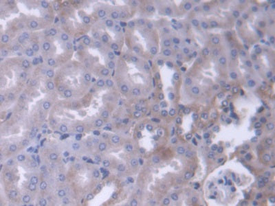 Alpha Adducin (ADD1) Polyclonal Antibody - image 4