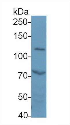 DAB staining on IHC-P; Samples: Human Kidney Tissue;  Primary Ab: 20μg/ml Rabbit Anti-Human ADD1 Antibody Second Ab: 2µg/mL HRP-Linked Caprine Anti-Rabbit IgG Polyclonal Antibody