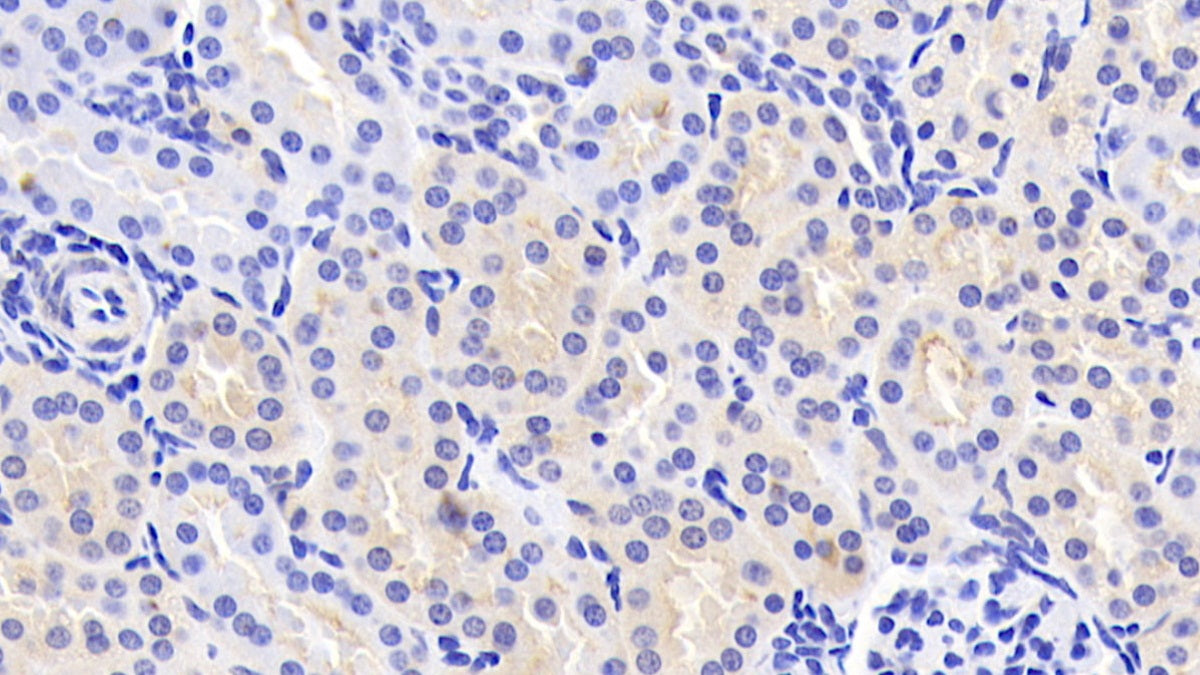 Alpha Adducin (ADD1) Polyclonal Antibody - image 4