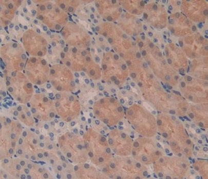 Acylphosphatase 2 (ACYP2) Polyclonal Antibody - image 4
