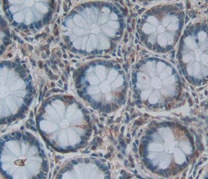 Acylphosphatase 2 (ACYP2) Polyclonal Antibody - image 3