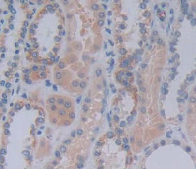 Acylphosphatase 1, Erythrocyte (ACYP1) Polyclonal Antibody - image 4