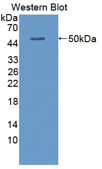 DAB staining on IHC-P; Samples: Human Liver Tissue; Primary Ab: 20μg/ml Rabbit Anti-Human ACY1 Antibody Second Ab: 2µg/mL HRP-Linked Caprine Anti-Rabbit IgG Polyclonal Antibody