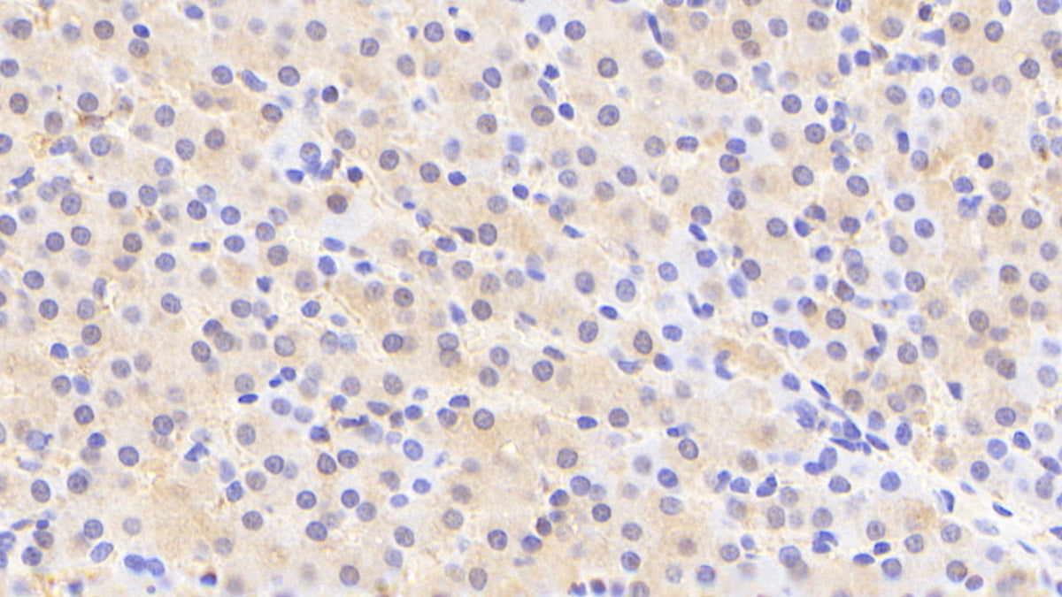 DAB staining on fromalin fixed paraffin- embedded kidney tissue)