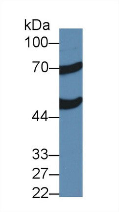 Western Blot; Sample: Recombinant protein.