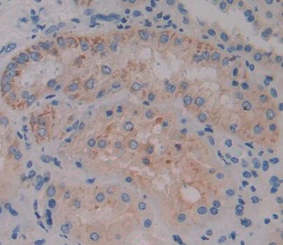 Acyl Coenzyme A Oxidase 1, Palmitoyl (ACOX1) Polyclonal Antibody - image 4