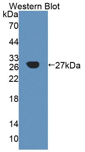 Alpha-1,4-Galactosyltransferase (a4GALT) Polyclonal Antibody - image 2