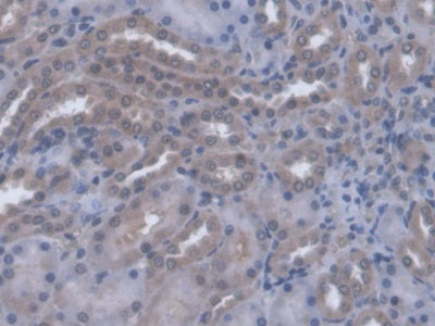 Alpha-1,4-Galactosyltransferase (a4GALT) Polyclonal Antibody - image 4