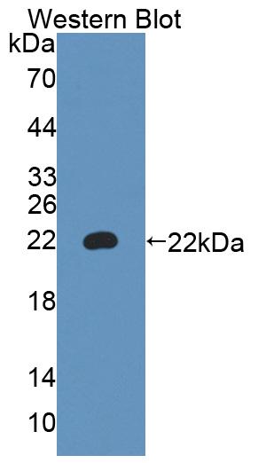 Alpha-1,4-Galactosyltransferase (a4GALT) Polyclonal Antibody - image 2