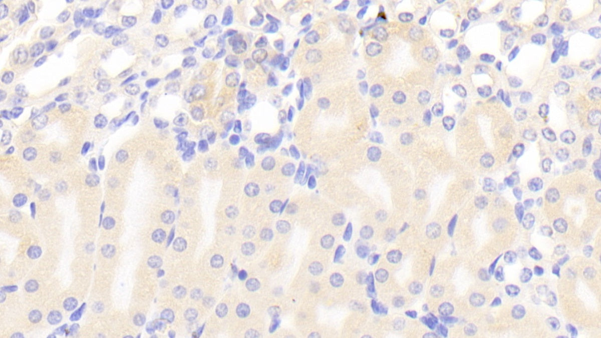 Alpha-1,4-Galactosyltransferase (a4GALT) Polyclonal Antibody - image 3