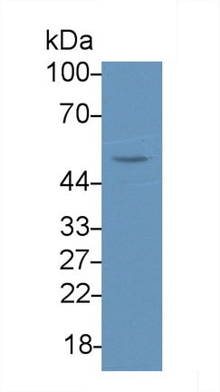 DAB staining on IHC-P; Samples: Human Kidney Tissue; Primary Ab: 20µg/ml Rabbit Anti-Human a4GALT Antibody Second Ab: 2µg/mL HRP-Linked Caprine Anti-Rabbit IgG Polyclonal Antibody