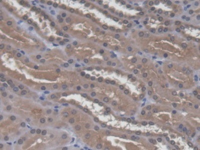 DAB staining on IHC-P; Samples: Human Kidney Tissue