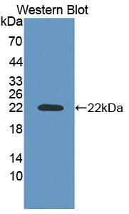Adrenocortical Dysplasia Homolog (ACD) Polyclonal Antibody - image 2