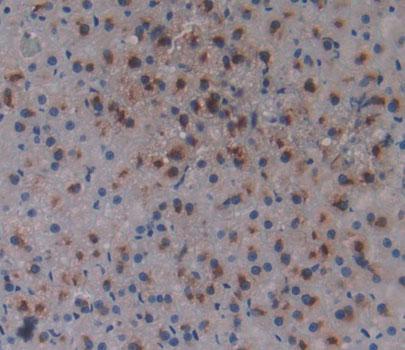 Adrenocortical Dysplasia Homolog (ACD) Polyclonal Antibody - image 3