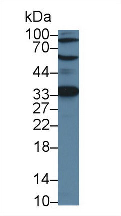 Western Blot; Sample: Recombinant protein.