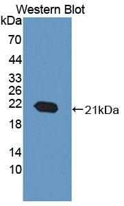 DAB staining on IHC-P; Samples: Mouse Colon Tissue;  Primary Ab: 20µg/ml Rabbit Anti-Mouse ACD Antib