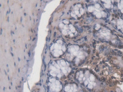 Adrenocortical Dysplasia Homolog (ACD) Polyclonal Antibody - image 5