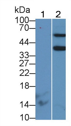 Aminoadipate Semialdehyde Phosphopantetheinyl Transferase (AASDHPPT) Polyclonal Antibody - image 3