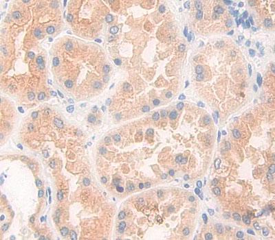 Aminoadipate Semialdehyde Phosphopantetheinyl Transferase (AASDHPPT) Polyclonal Antibody - image 4