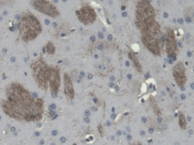 DAB staining on IHC-P; Samples: Mouse Cerebrum Tissue