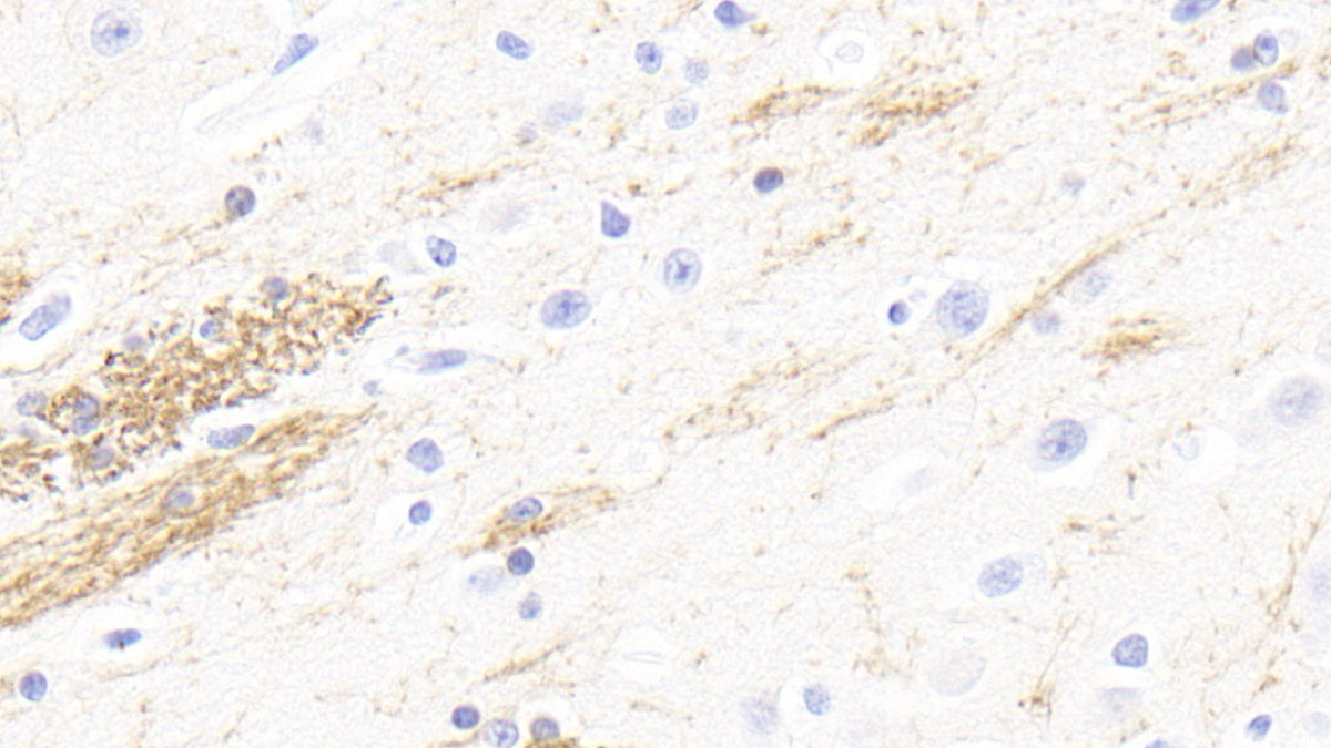 DAB staining on fromalin fixed paraffin- embedded brain tissue)