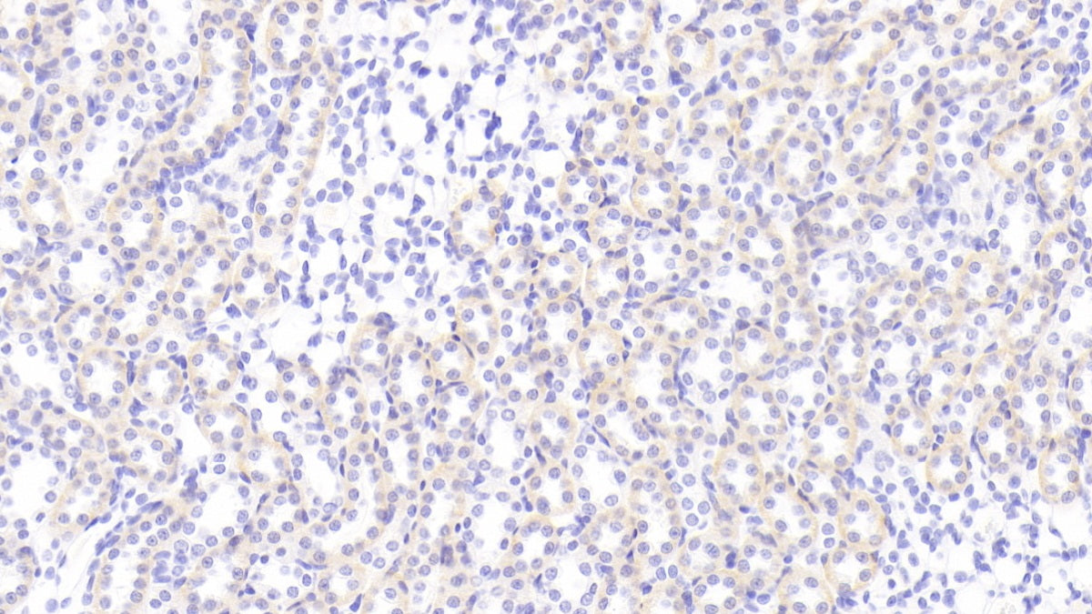 11-Beta-Hydroxysteroid Dehydrogenase Type 1 (HSD11b1) Polyclonal Antibody - image 4