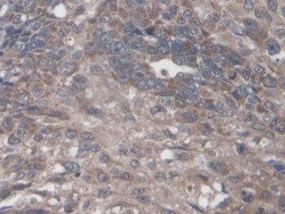 DAB staining on fromalin fixed paraffin- embedded kidney tissue)