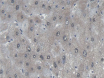 Protein Tyrosine Phosphatase Receptor Type F (PTPRF) Polyclonal Antibody - image 4
