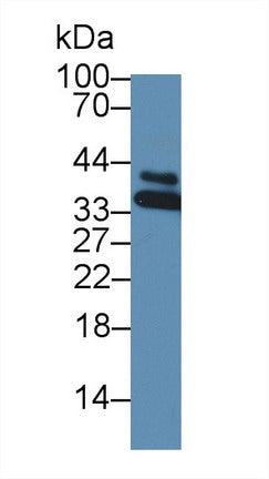 Western Blot; Sample: Recombinant protein.