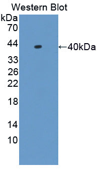DAB staining on IHC-P; Samples: Mouse Colon Tissue; Primary Ab: 20µg/ml Rabbit Anti-Mouse HNRPA1 Antibody Second Ab: 2µg/mL HRP-Linked Caprine Anti-Rabbit IgG Polyclonal Antibody