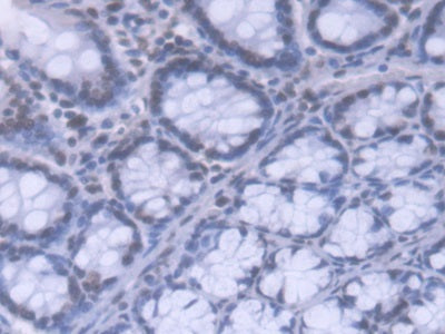 DAB staining on fromalin fixed paraffin- embedded Kidney tissue)