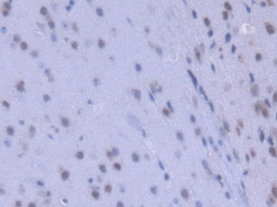 Heterogeneous Nuclear Ribonucleoprotein A1 (HNRNPA1) Polyclonal Antibody - image 5