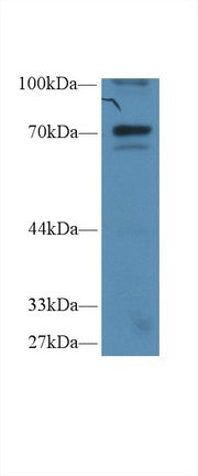 Western Blot; Sample: Recombinant protein.