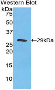 DAB staining on IHC-P; Samples: Human Spleen Tissue;  Primary Ab: 20μg/ml Rabbit Anti-Human IkBz Antibody Second Ab: 2µg/mL HRP-Linked Caprine Anti-Rabbit IgG Polyclonal Antibody