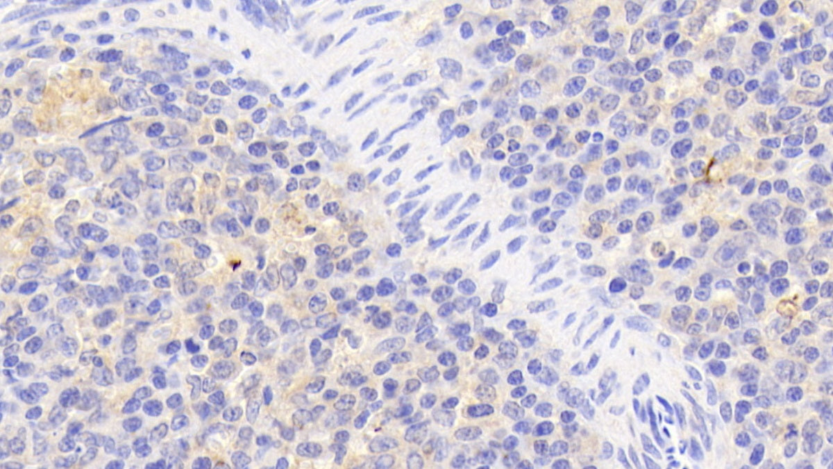 Inhibitory Subunit Of NF Kappa B Zeta (IkBz) Polyclonal Antibody - image 4