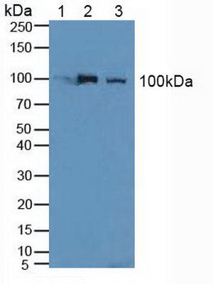 Western Blot; Sample: Recombinant NCL, Human.