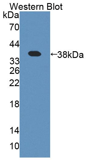 Amyloid Beta Precursor Protein Binding Protein 1 (APPBP1) Polyclonal Antibody - image 2