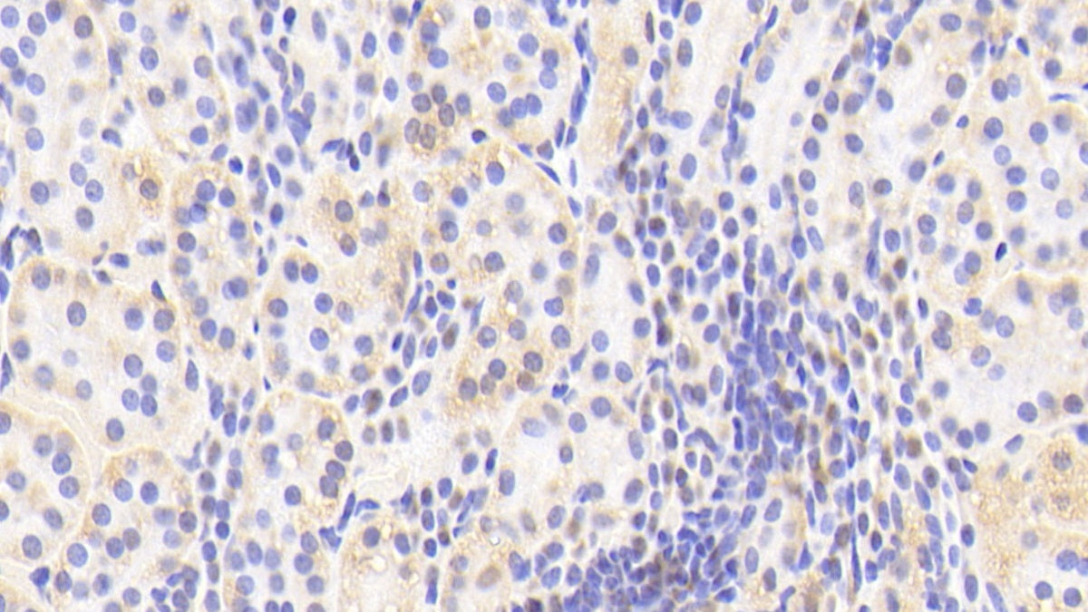 DAB staining on fromalin fixed paraffin- embedded kidney tissue)